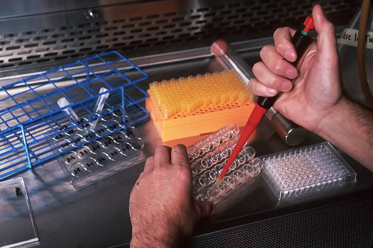 HPLC laboratuvar ekipmanı